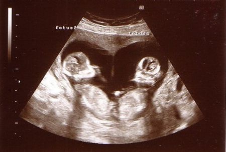 Picture for category Expecting Multiples